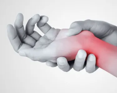 Carpal Tunnel Syndrome