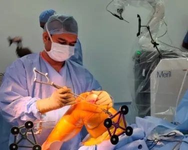 A Team of doctors is performing Robotic Knee Surgery
